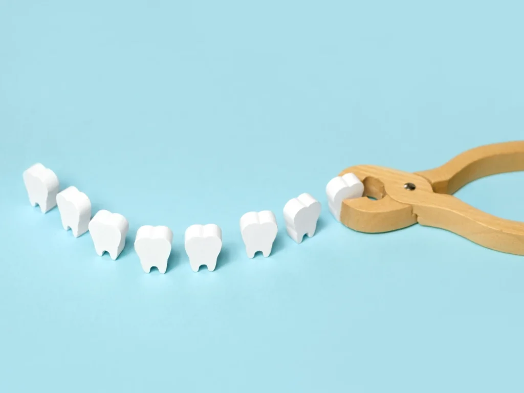 emergency tooth extraction Eugene, OR